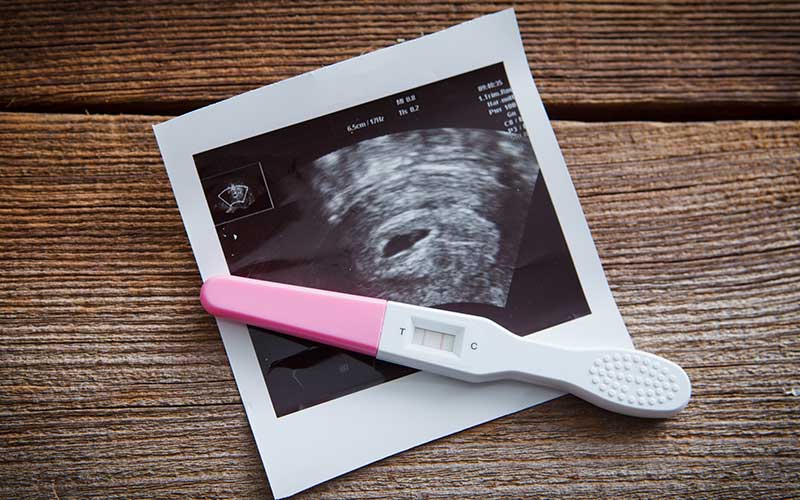 FIV paso a paso: 5. El test de embarazo después de una Fecundación in Vitro (FIV)